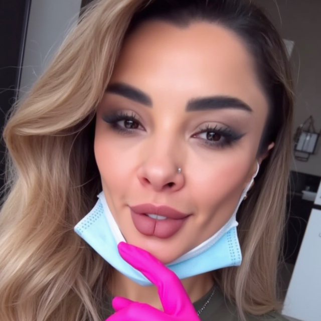Doctor Botox ?